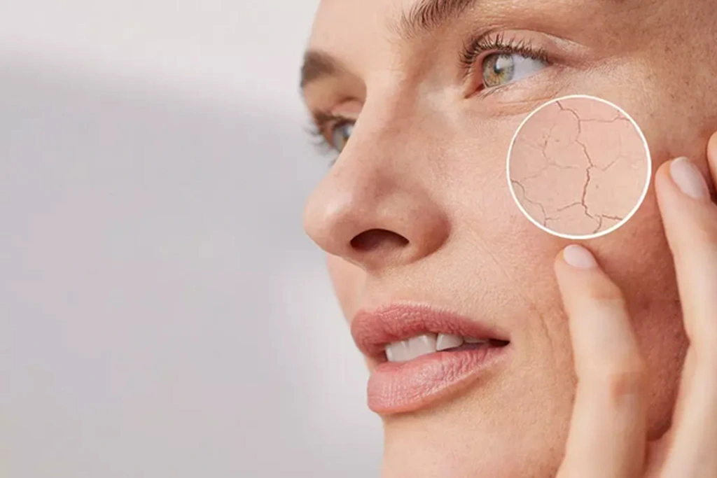 خشکی شدید و کم آبی