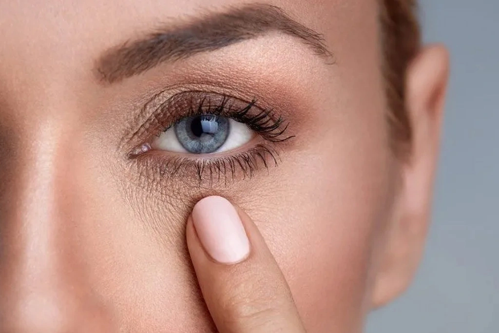 تیره شدن دور چشم و پف