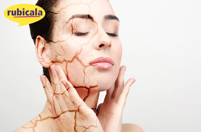 برای شروع درمان پوست خشک، بهتر است ابتدا میزان خشکی پوست خود را بشناسید.
