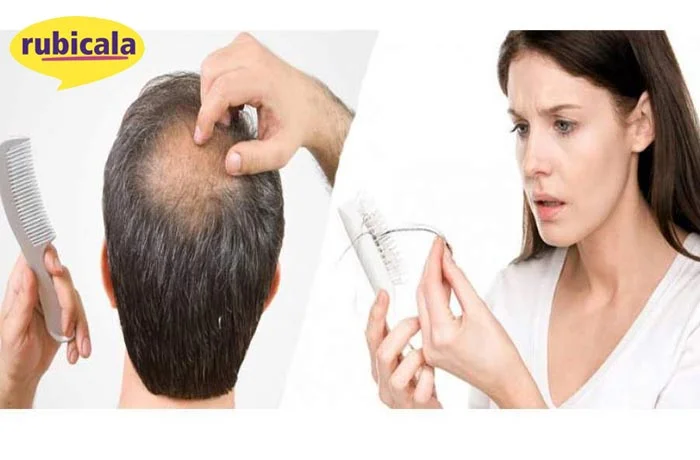 عوامل مختلفی در ریزش مو نقش دارند.
