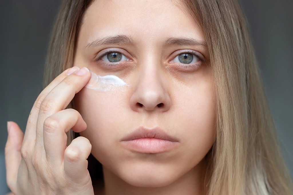 بهترین کرم دور چشم برای رفع سیاهی، گودی و پف زیر چشم-فروشگاه روبیکالا